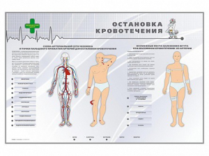 Электрифицированный стенд "Остановка кровотечения" - fgospostavki.ru - Владимир