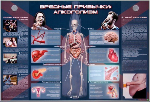Электрифицированный стенд "Вредные привычки: алкоголизм" - fgospostavki.ru - Владимир